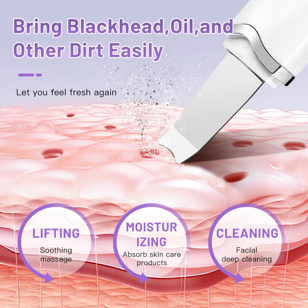 Electric Ultrasonic Skin Scrubber – Face Spatula for Blackhead Removal & Facial Lifting