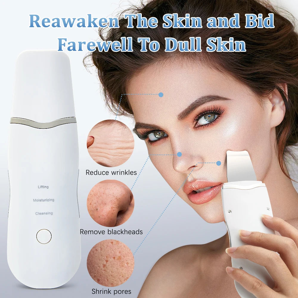 Electric Ultrasonic Skin Scrubber – Face Spatula for Blackhead Removal & Facial Lifting