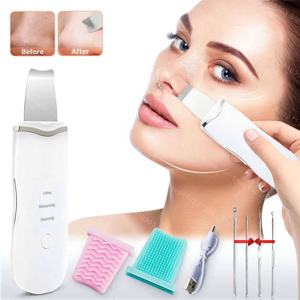 Electric Ultrasonic Skin Scrubber – Face Spatula for Blackhead Removal & Facial Lifting