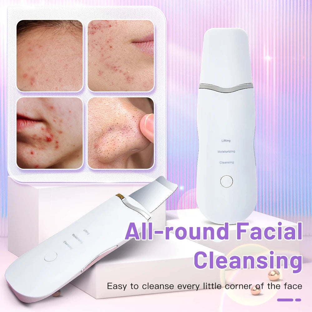 Electric Ultrasonic Skin Scrubber – Face Spatula for Blackhead Removal & Facial Lifting