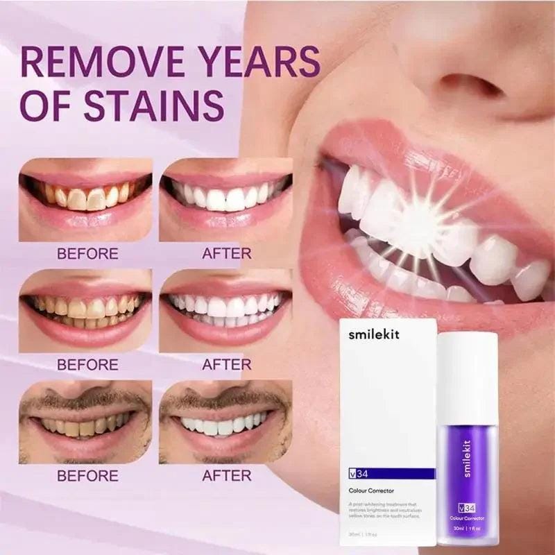 V34 SmileKit 30ml Purple Toothpaste: Tartar Removal & Whitening for Fresh Breath - storedevanci